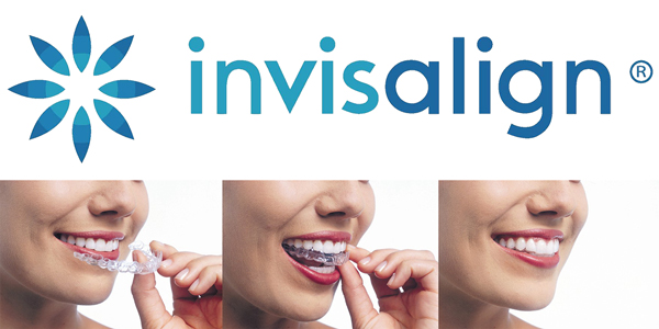 Orthodontic Treatment with Transparent Plate (invisalign) - Aesthetics  Clinic