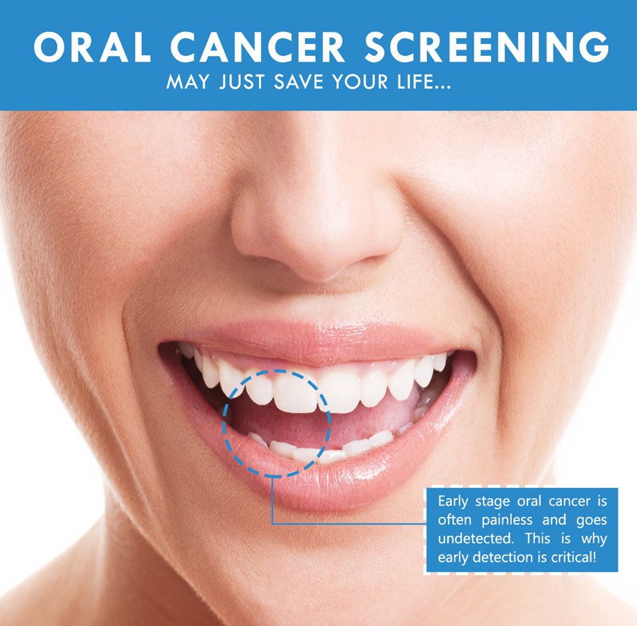 Did You Know That April is Oral Cancer Awareness Month?